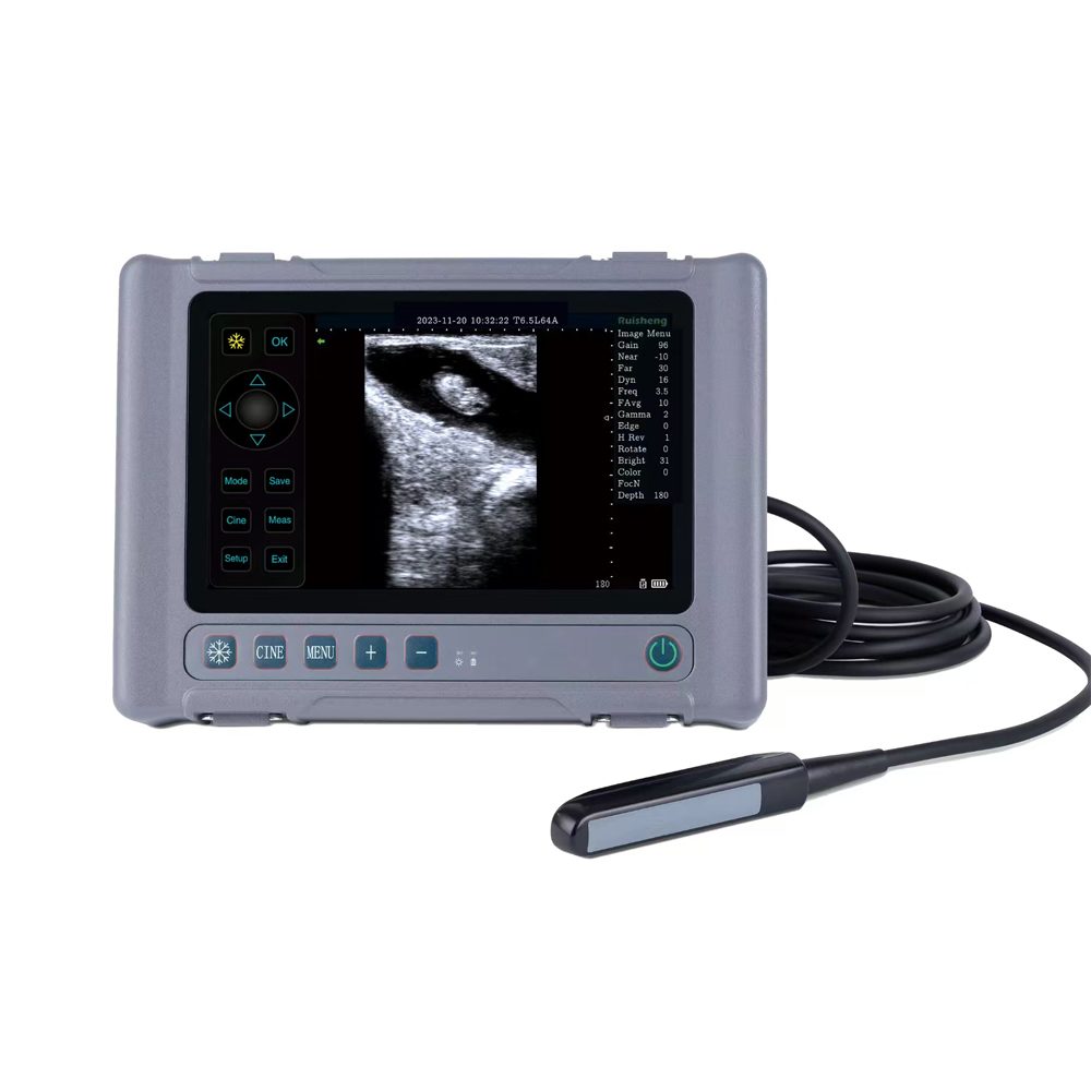 Full Digital Ultrasound Diagnostic System